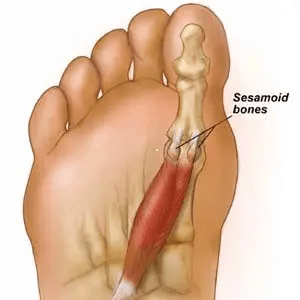 Sesamoid Picture